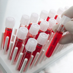 Общий анализ крови и его значение для диагностики заболеваний
