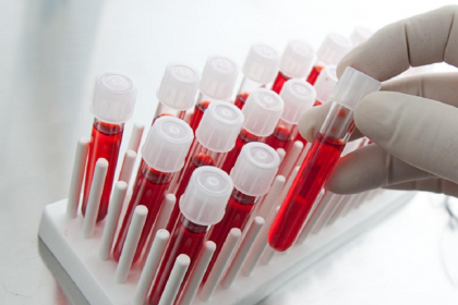 Общий анализ крови и его значение для диагностики заболеваний