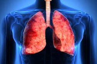 Как распознать туберкулез легких