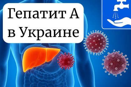 Вспышка гепатита А в Киеве: что известно и как защитить здоровье