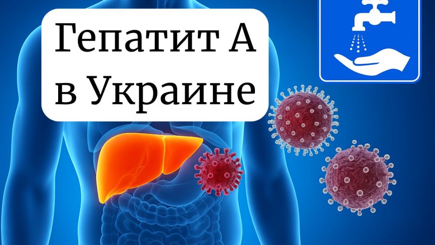 Вспышка гепатита А в Киеве: что известно и как защитить здоровье