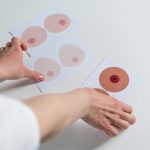 Почему болят соски: причины, заболевания и когда нужно обратиться к врачу