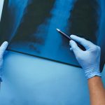 Как избежать пневмонии осенью 2025 года: советы по профилактике