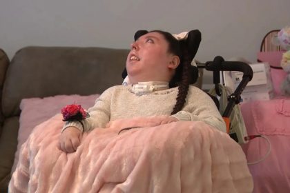 Девочка без мозга отпраздновала 20-летие: как любовь и вера победили прогнозы врачей