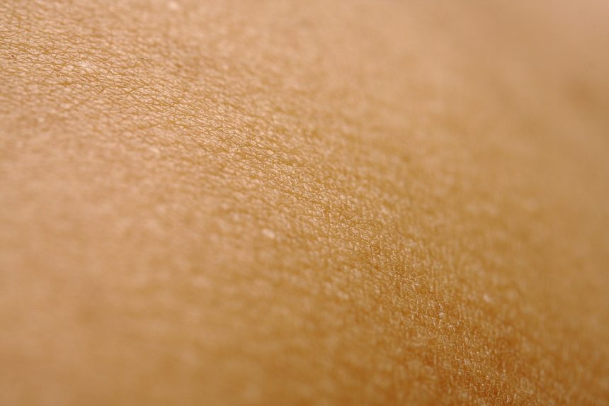 Периоральный дерматит: причины, симптомы и способы лечения