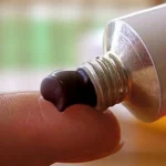 Эффективна ли мазь Вишневского: хирург предупреждает об опасности