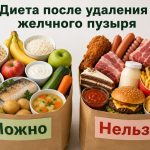 Как питаться после удаления желчного пузыря: меню, диета и правила восстановления