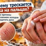 Трескаются пальцы рук с приходом холодов: аллергия, экзема или сухость кожи