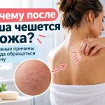 Почему после душа чешется кожа без сыпи: основные причины зуда и когда нужно обследование